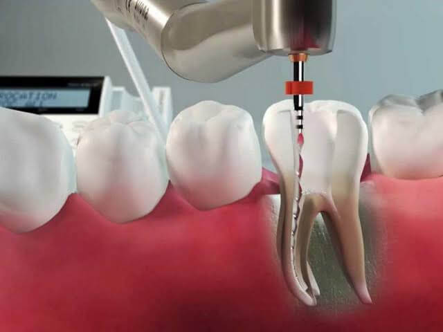 Endodontia